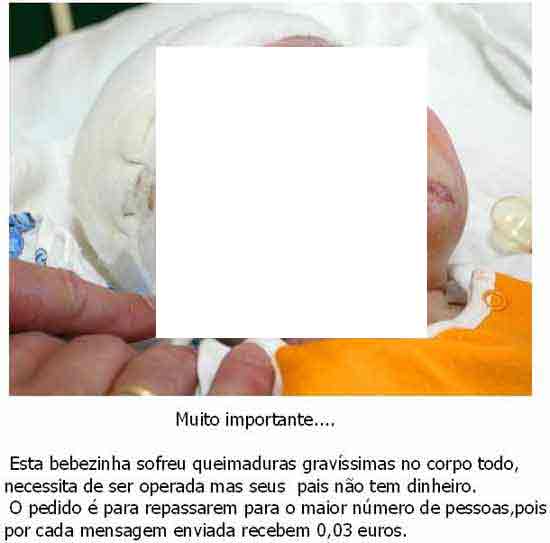 Bebezinha queimada