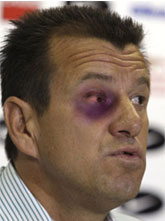 Dunga