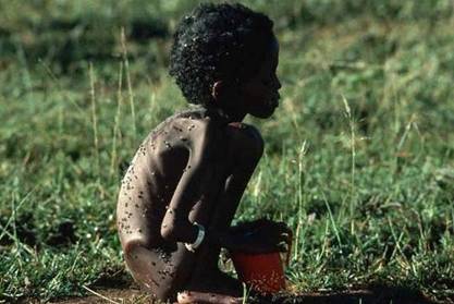 Fome na África